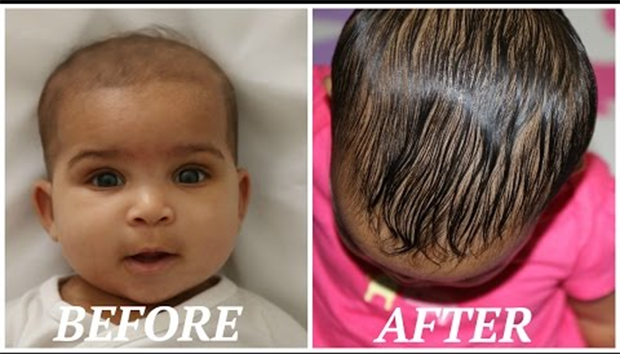 Try these methods for fast hair growth of children | IG News